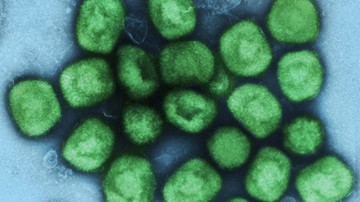 Експерти: Вірус віспи мавп не виник у жодній лабораторії