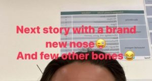 Смертельна травма Каміля Грабари. Поляк показав фото з лікарні Смертельна травма Каміля Грабари. Поляк показав фото з лікарні