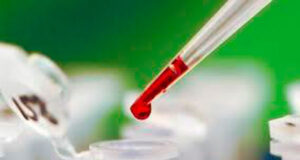 Ліпаза підвищена в крові причини