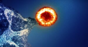 Ближче до ефективних ліків від СНІДу? Третій випадок ВІЛ-інфікованого вилікувався Ближче до ефективних ліків від СНІДу? Третій випадок ВІЛ-інфікованого вилікувався