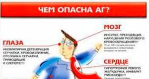 Как проявляется артериальная гипертензия