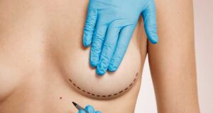 Яка ціна підтяжки грудей в Україні?