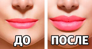 Как можно увеличить губы?