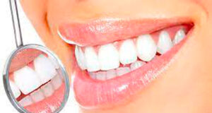 Роль цифрових технологій в естетичній стоматології: дизайн посмішки, комп’ютерне моделювання