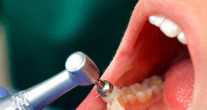 Почему болит зуб под пломбой?